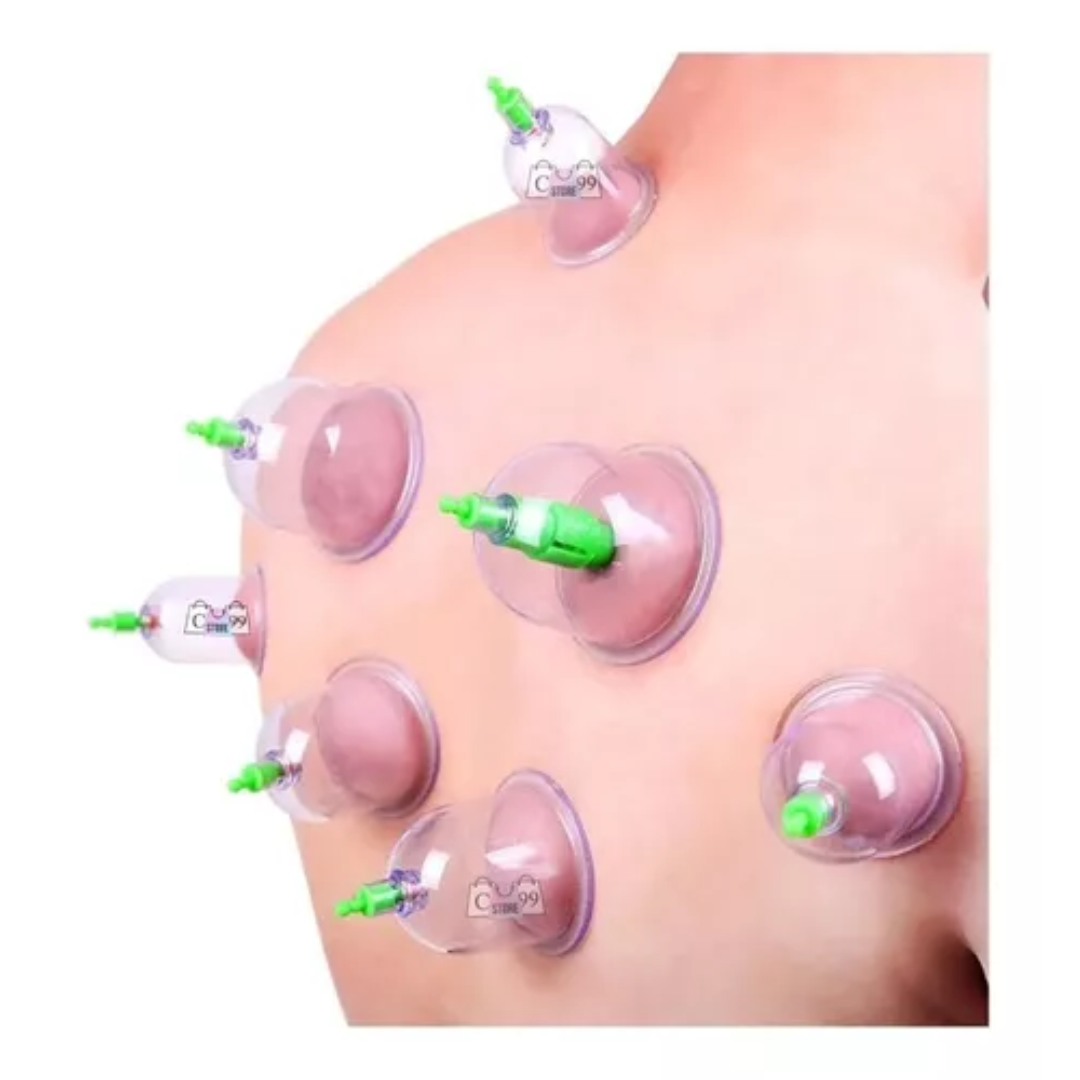 Vacuum Terapia Manual Para Masaje