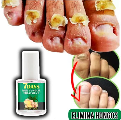 7 Days Nails endurecedor de Uñas X 3 Unidades