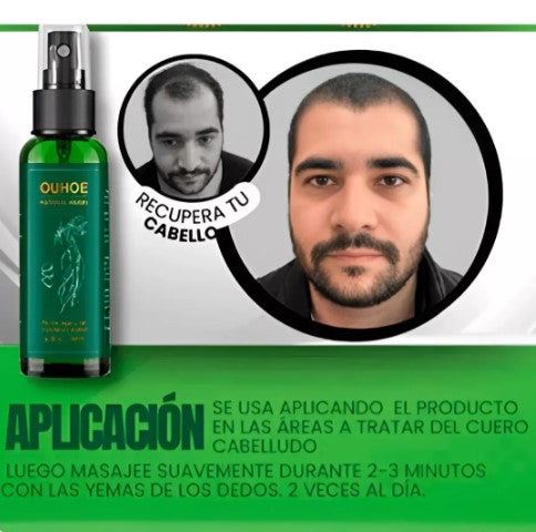 Spray Para Crecer El Pelo OUHOE 100 ml